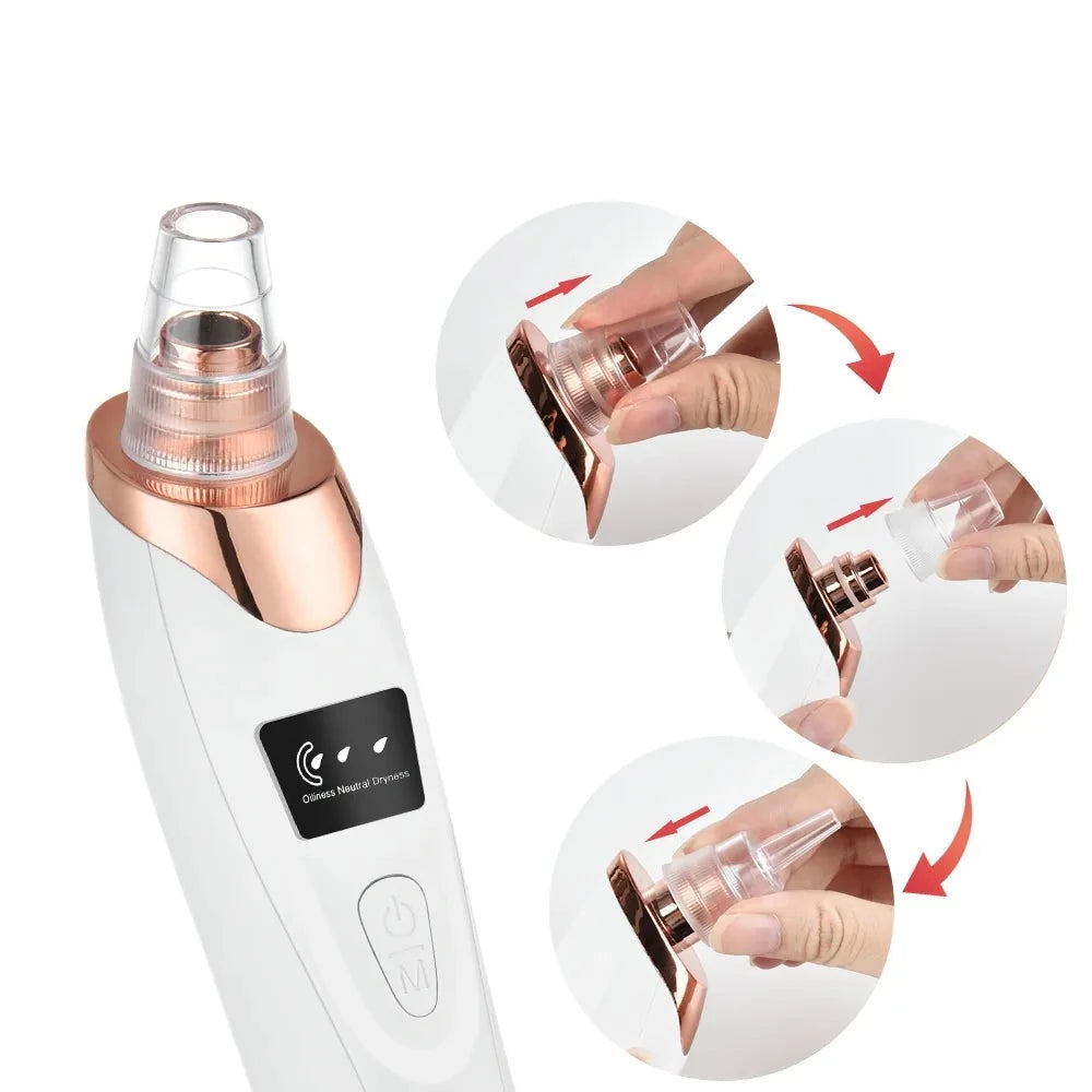 Electric Blackhead Remover Vacuum