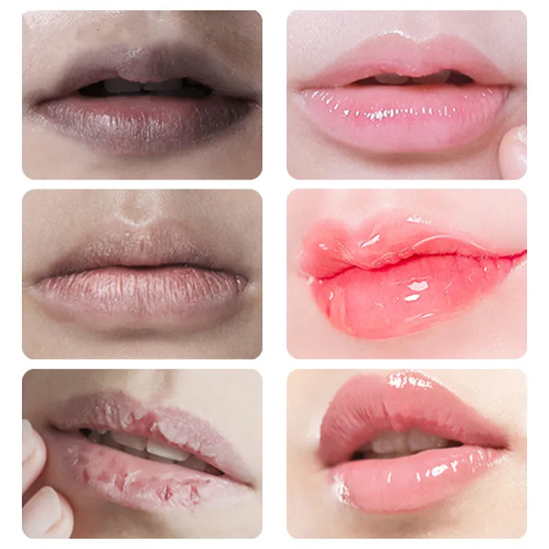 Remove Dark Lip Balm